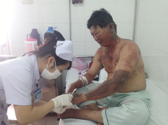Anh Mai Xuân Long đang được nhân viên y tế chăm sóc vết thương bị bỏng do cháy xăng