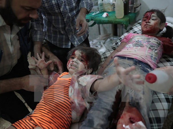 Trẻ em bị thương trong xung đột giữa quân Chính phủ Syria và lực lượng nổi dậy ở thị trấn Douma, phía Đông thủ đô Damascus. (Nguồn: AFP/TTXVN)