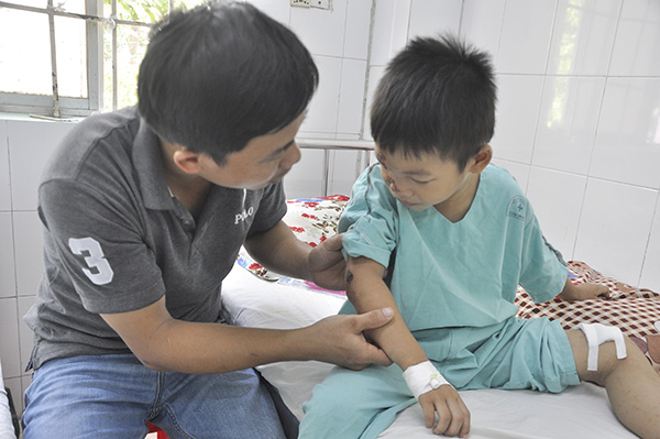 Một trường hợp trẻ em bị thương do tai nạn giao thông đang điều trị tại Bệnh viện nhi đồng Đồng Nai.