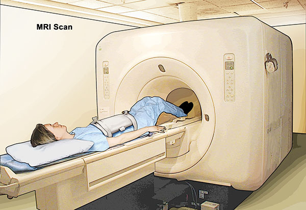 Chụp MRI là giải pháp chẩn đoán hiệu quả nhưng là nỗi sợ hãi của nhiều người. Ảnh minh họa của National Cancer Institute