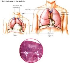 Cần làm gì khi có khối u trên xương ức?