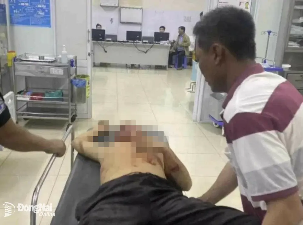 Một nạn nhân được đưa đến cấp cứu tại Bệnh viện Đa khoa khu vực Long Khánh.
