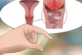 Bị vệt trắng cổ tử cung có tiêm ngừa HPV được không?