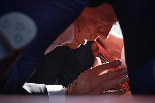 Ông Trump bị thương ở tai phải. Nguồn: Getty Images