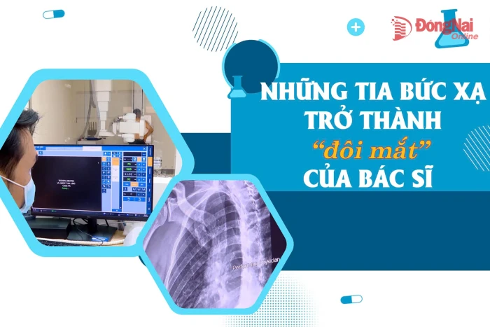[Video] Những tia bức xạ trở thành ‘đôi mắt’ của bác sĩ
