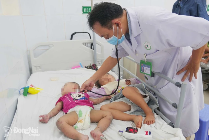Cao điểm bệnh tay chân miệng