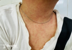 Bình tĩnh để phòng ngừa dịch bệnh hiệu quả