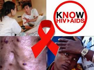 HIV