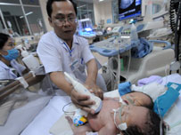 The conjoined twins are put under special treatment at the Childrens Hospital 1 in Ho Chi Minh City. (Photo: Tuoi Tre newspaper)