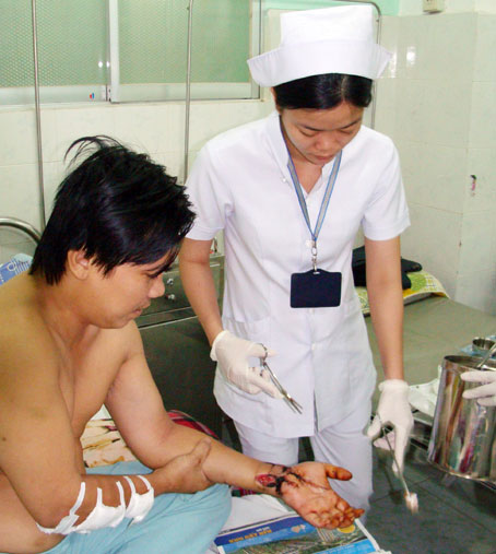 Nối thành công bàn tay bị đứt lìa