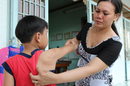 Đi học thêm bị cô giáo đánh gây thương tích