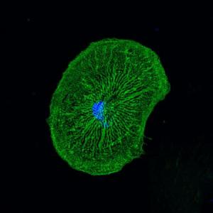 Scientists turn skin cells into beating heart muscle