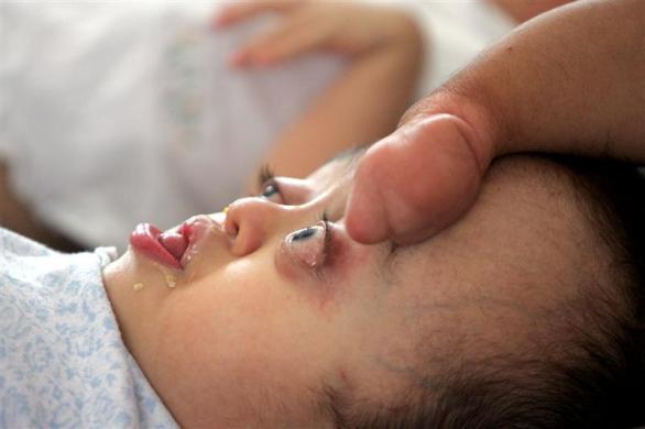 3.	A disfigured arm of a Vietnamese boy disabled by Agent Orange strokes another victim in a Ho Chi Minh City hospital, February 25, 2005.