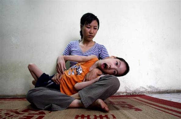 6.	Ten-year-old Pham Duc Duy is cradled in the arms of his mother, Nguyen Thi Thanh Van, 35, in their house in Hanoi, June 16, 2007.