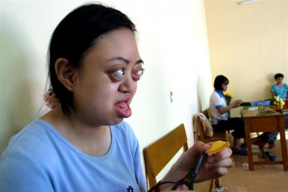 9.	Vietnamese Agent Orange victim, 18-year-old Nguyen Thi Van Long, cuts a paper flower at the Friendship Village, a hospice for Agent Orange victims, in Hanoi, September 6, 2004.