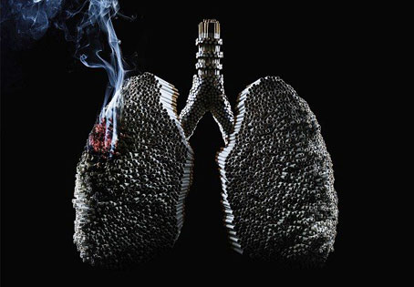 Hút thuốc lá rất có hại cho sức khỏe, đặc biệt là gây ung thư phổi