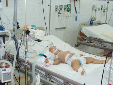 Một em bé bị sốt xuất huyết điều trị tại BV nhi đồng Đồng Nai
