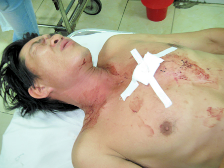 Chống người thi hành công vụ, bị bắn vào ngực