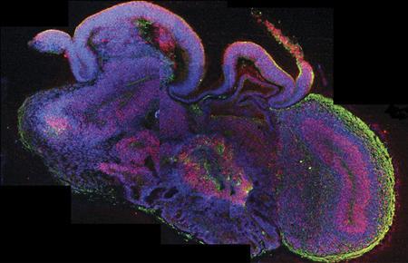 Scientists grow "mini human brains" from stem cells