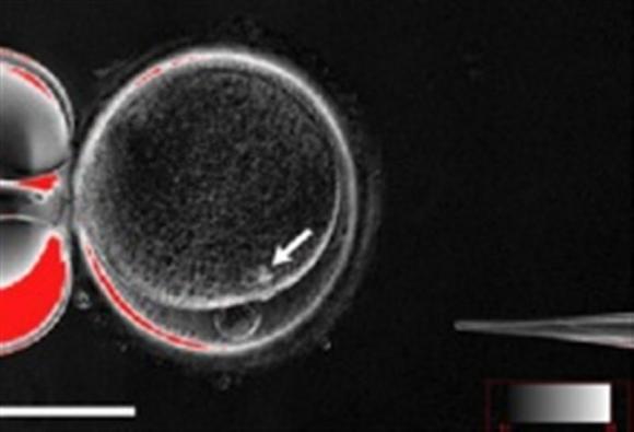 A handout picture shows the process by which scientists created patient-specific stem cell lines out of the skin cells of two adult men.  