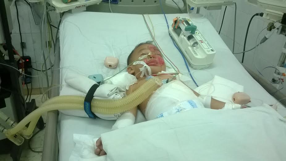 Bé Thiên Hòa đang được điều trị tại Bệnh viện nhi đồng Đồng Nai