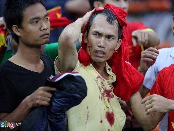 Cổ động viên Việt Nam bị hành hung ở Malaysia. (Ảnh: Zing.vn)
