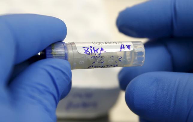 A health technician analyzes a blood sample from a patient bitten by a mosquito at the National Institute of Health in Lima, Peru, February 2, 2016.