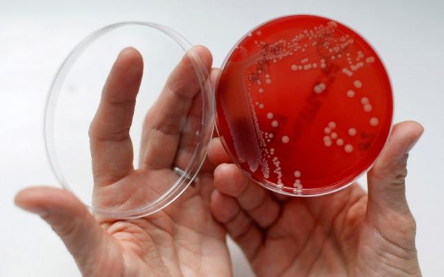  An employee displays MRSA (Methicillin-resistant Staphylococcus aureus) bacteria strain inside a petri dish containing agar jelly for bacterial culture in a microbiological laboratory in Berlin March 1, 2008. 