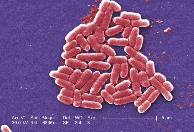  The mcr-1 plasmid-borne colistin resistance gene has been found primarily in Escherichia coli, pictured. 