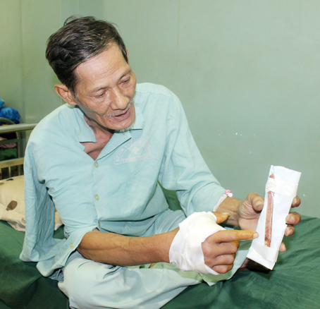 Cảnh báo tai nạn lao động từ máy cưa gỗ đa năng