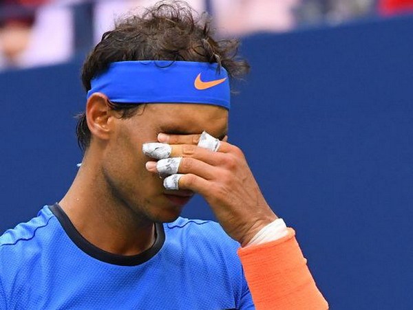 Rafael Nadal thua sốc, vỡ mộng "đại chiến trong mơ" ở US Open
