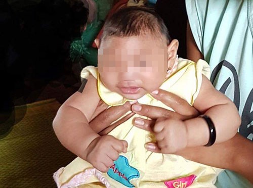 Vietnam confirms first Zika-tied birth defect case