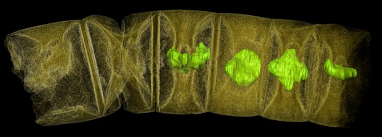 An X-ray tomographic picture of fossil thread-like red algae, tinted to show detail, unearthed in central India may represent the oldest-known plants on Earth, dating from 1.6 billion years ago, according to research published in the journal PLOS Biology in this image