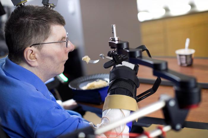 Bill Kochevar, 56, is using computer-brain interface technology and an electrical stimulation system to move his own arm after eight years of paralysis, in this undated handout photo. 