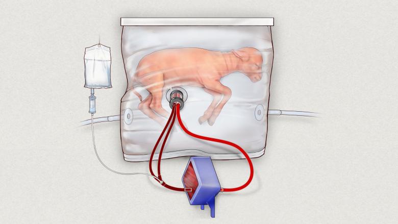  An artists impression shows a lamb inside a fluid-filled womb-like bag known as an extra-uterine support device developed by the Children's Hospital of Philadelphia.MANDATORY CREDIT Children's Hospital of Philadelphia handout via REUTERS