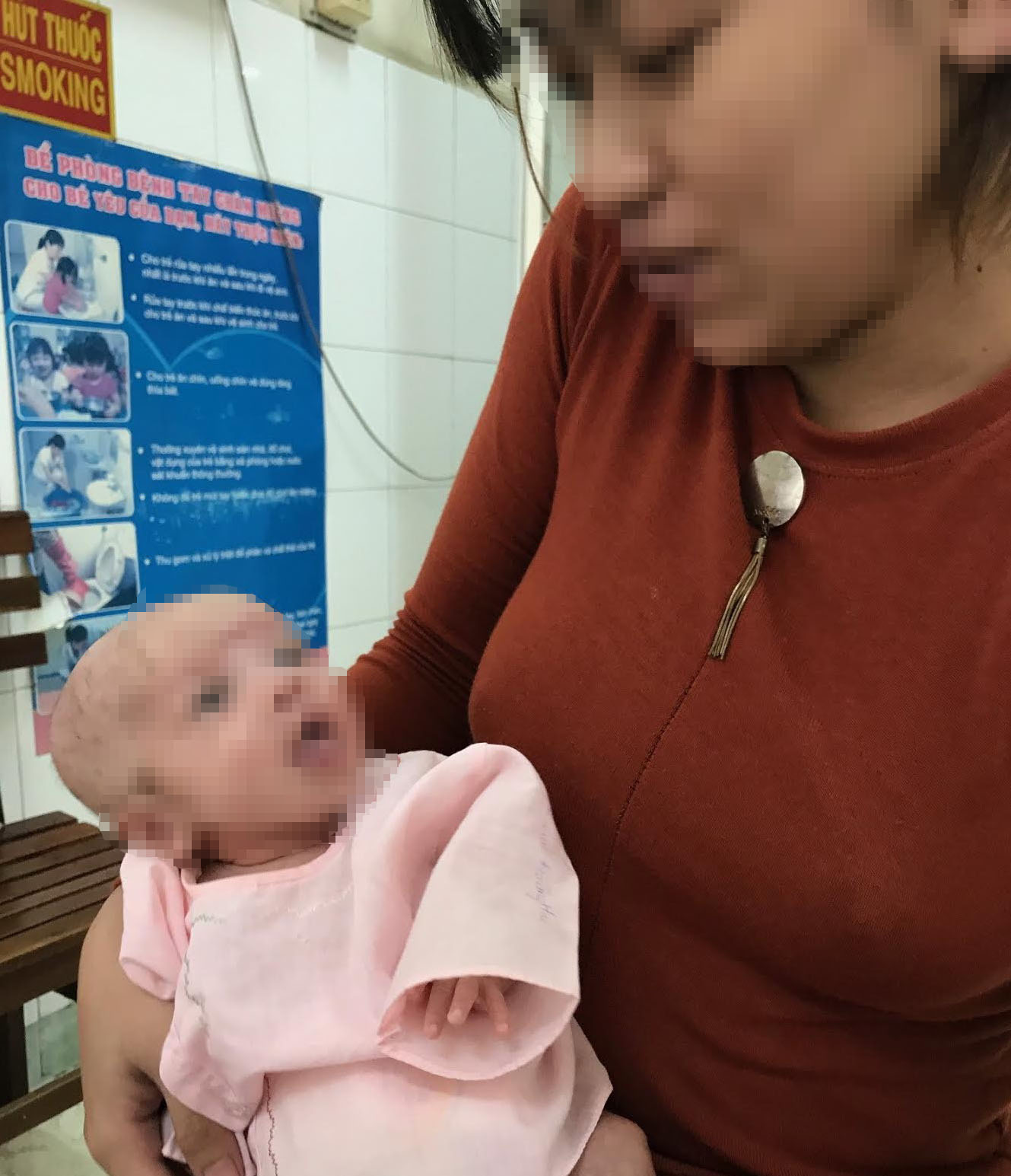 Cứu bé sơ sinh thoát 2 dị tật nguy hiểm