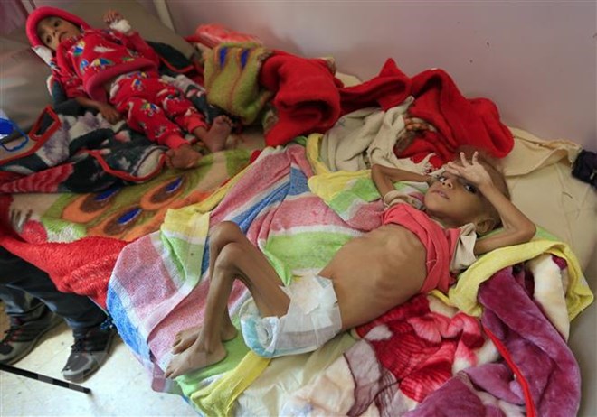 Hơn 85.000 trẻ em chết vì đói và bệnh tật tại Yemen trong 3 năm qua