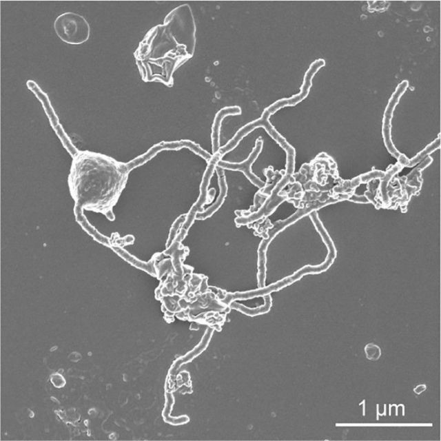 A scanning electron microscopy image of the single-celled organism Prometheoarchaeum syntrophicum strain MK-D1 showing the cell with tentacle-like branching protrusions is seen in this image released at the Japan Agency for Marine-Earth Science and Technology (JAMSTEC) in Yokosuka, Japan on January 15, 2020.