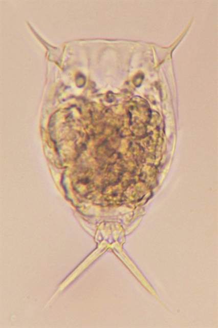 A microscope photo of a new rotifer species -- Lecane Langsenensis -- found bybiologists from Đà Nẵng. It's one of five rotifer species that were discovered.