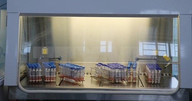Samples for COVID-19 testing stored in a biosafety cabinet (Photo: VNA)