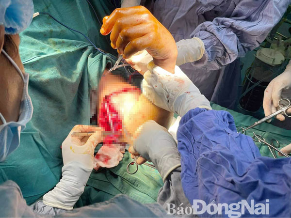 Doctors reconnect 41-year-old man's arm in emergency surgery