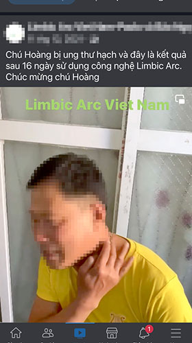 Một tài khoản Facebook đăng quảng cáo ứng dụng điện tử Limbic Arc có thể chữa được ung thư. Ảnh: Phương Liễu