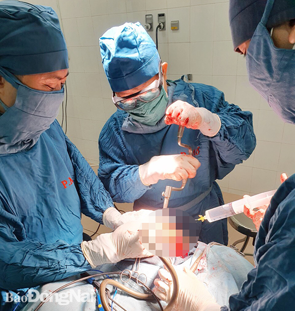 Bác sĩ mổ chấn thương sọ não cho bệnh nhi tại Bệnh viện nhi đồng Đồng Nai