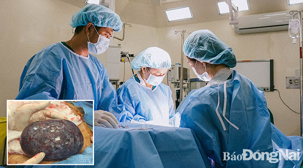 Các bác sĩ thực hiện ca phẫu thuật cắt bỏ khối u buồng trứng “khủng”. Ảnh nhỏ: Khối u buồng trứng khổng lồ bị hoại tử được loại bỏ khỏi cơ thể bệnh nhân