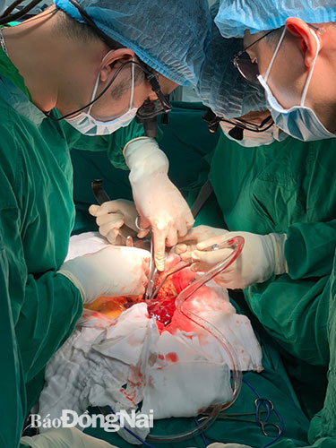 Các bác sĩ thực hiện ca phẫu thuật vỡ phình động mạch chủ bụng cho bệnh nhân